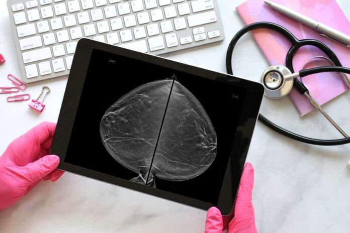 A person in pink gloves holding a tablet displaying a mammogram image