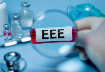 Ebola Scare Hits South American Country Magnifying glass over test tube labeled EEE