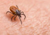 Brown tick crawling on human skin surface