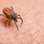 Brown tick crawling on human skin surface