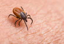 Brown tick crawling on human skin surface