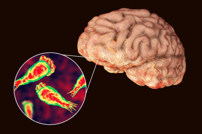 Brain with zoomed-in view of amoeba infection.