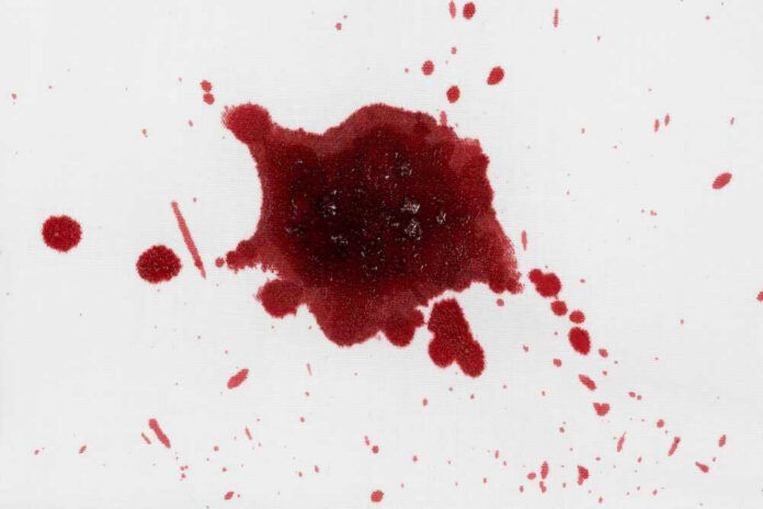 shutterstock_2439757693 Red liquid splatter on a white background.