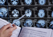 Scary Link Emerges: Memory Decline Person analyzing brain MRI images with a pen.