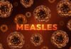 Illustration of measles virus particles with the word 'MEASLES' in bold