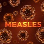 Measles Emergency Triggers Unusual Power Shift Illustration of measles virus particles with the word 'MEASLES' in bold