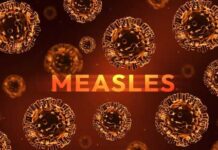 Measles Emergency Triggers Unusual Power Shift Illustration of measles virus particles with the word 'MEASLES' in bold